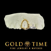 Custom Two-Tone Double Cap Grillz with White Trillion Tip & Yellow Gold Open Face | Made to Order | Includes Mold Kit | Gold Time Killeen