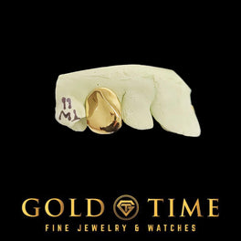 Yellow gold single tooth grillz cap fitted to a marked dental mold