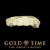 Custom 2-Piece Solid with Trillion Tip Canines Two Tone Silver or Gold