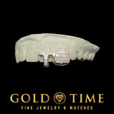 Custom Double Cap Grillz with Invisible-Set Moissanite Cross