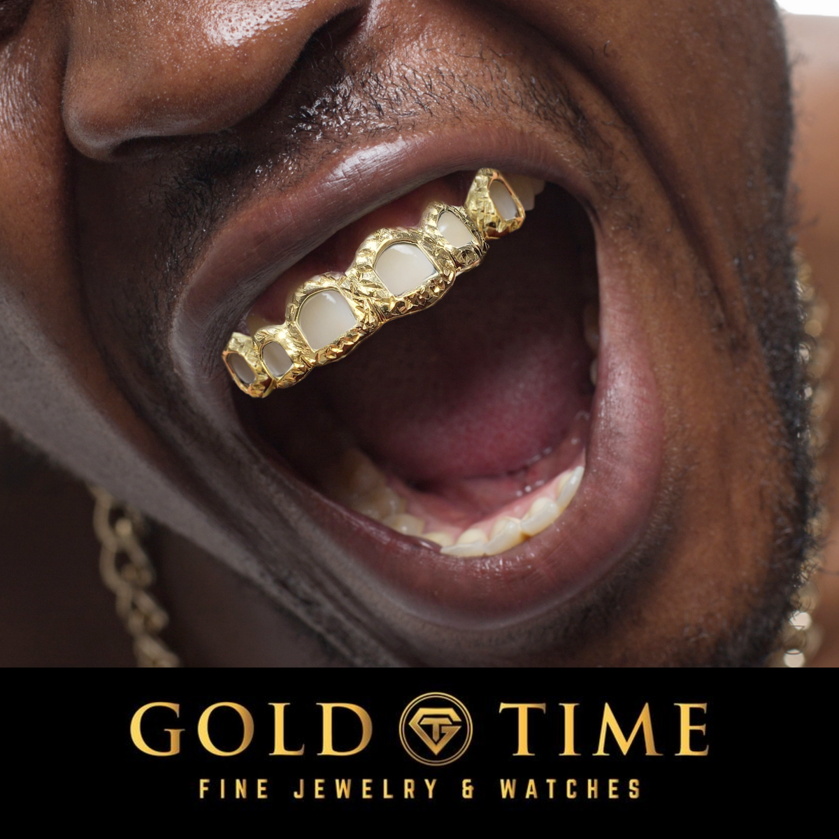 How Should Grillz Fit? Tight vs. Loose Grillz Explained
