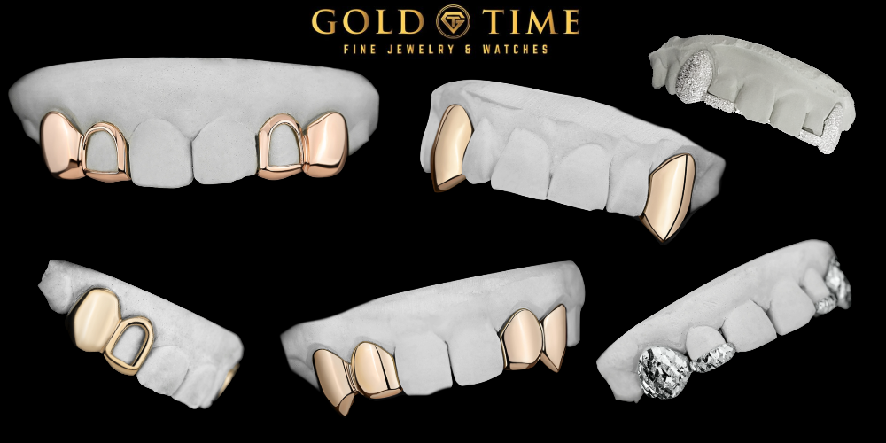 Open Face vs Solid Grillz: Which Should You Choose?