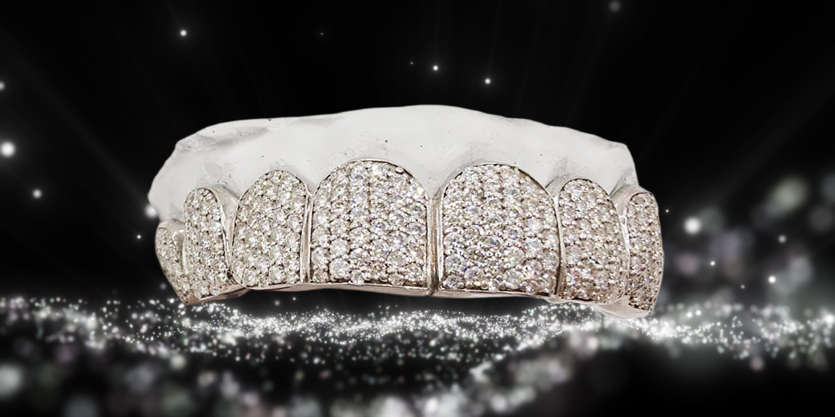 Are Grillz Permanent? How to Take Them Off