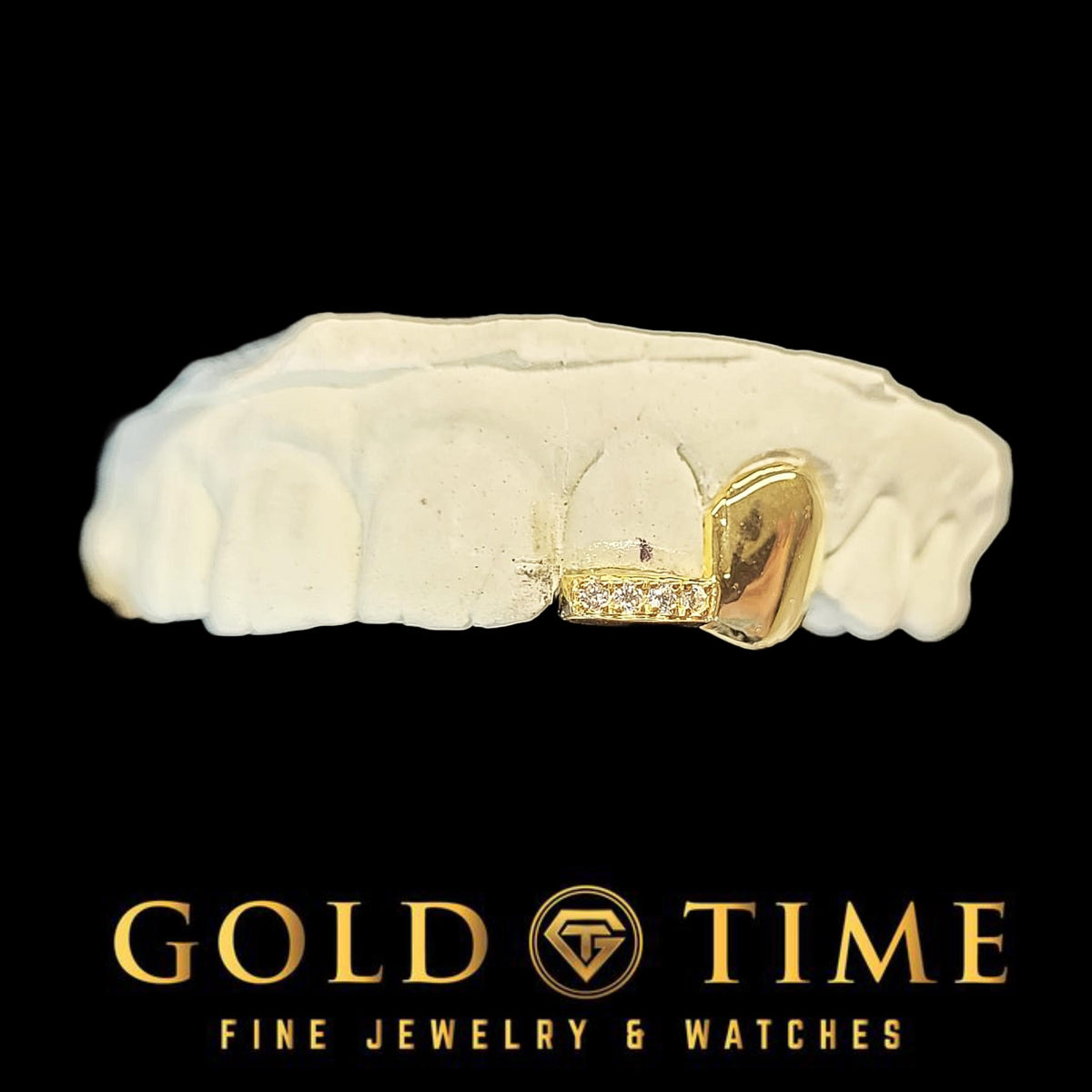 Yellow gold double cap grillz with a solid canine and a moissanite tipped incisor on a dental mold