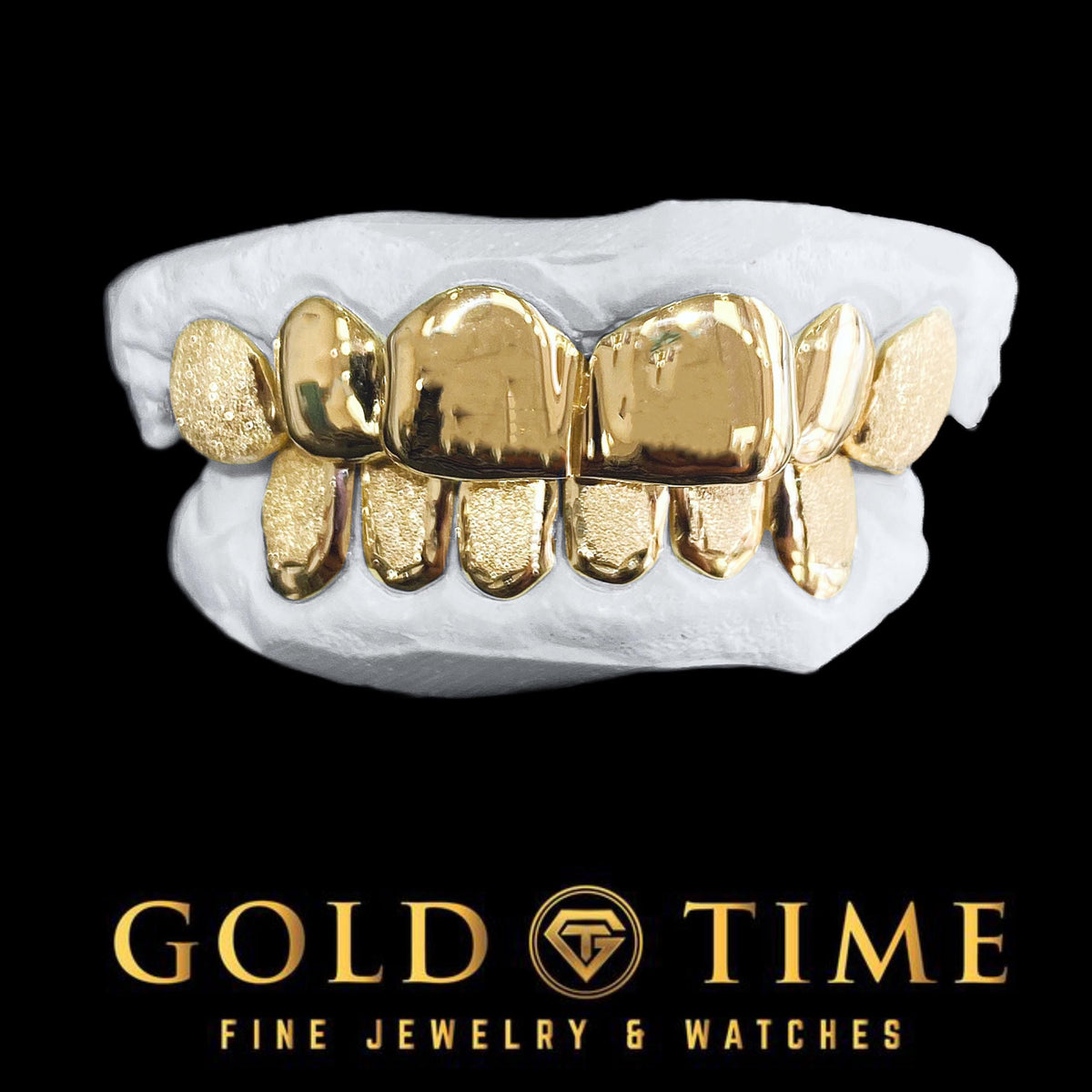 Solid vs. Gold-Plated Grillz: What's the Difference?