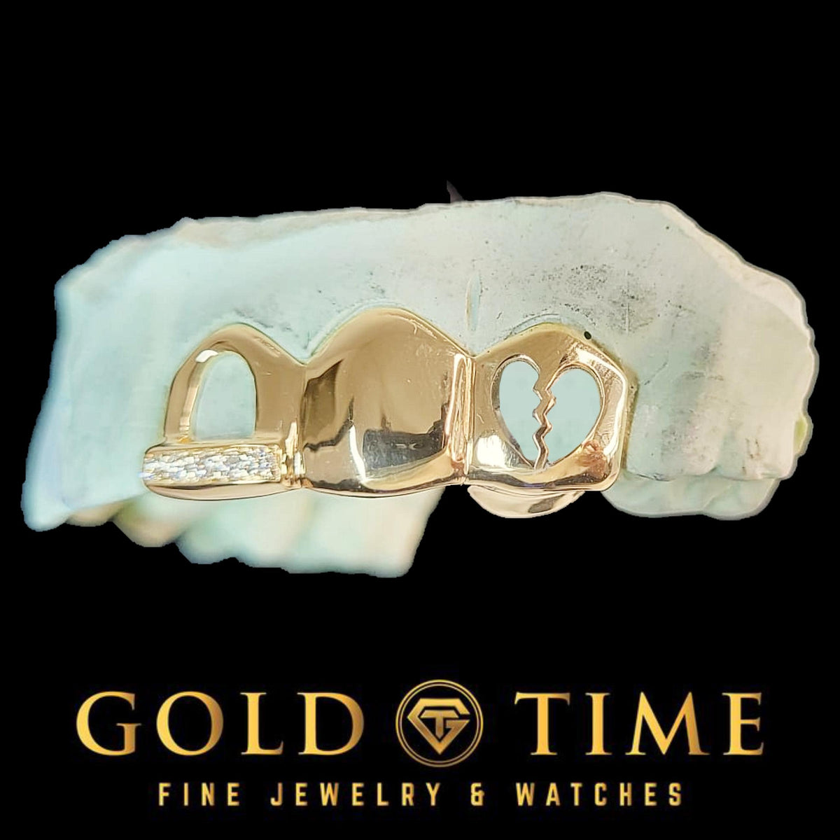 Can You Get Grillz If You Have a Gap or Missing Teeth?