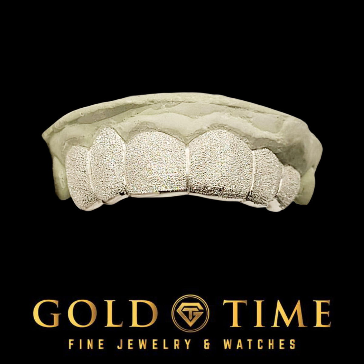 Custom-fit diamond dust grillz set made from an individual dental impression