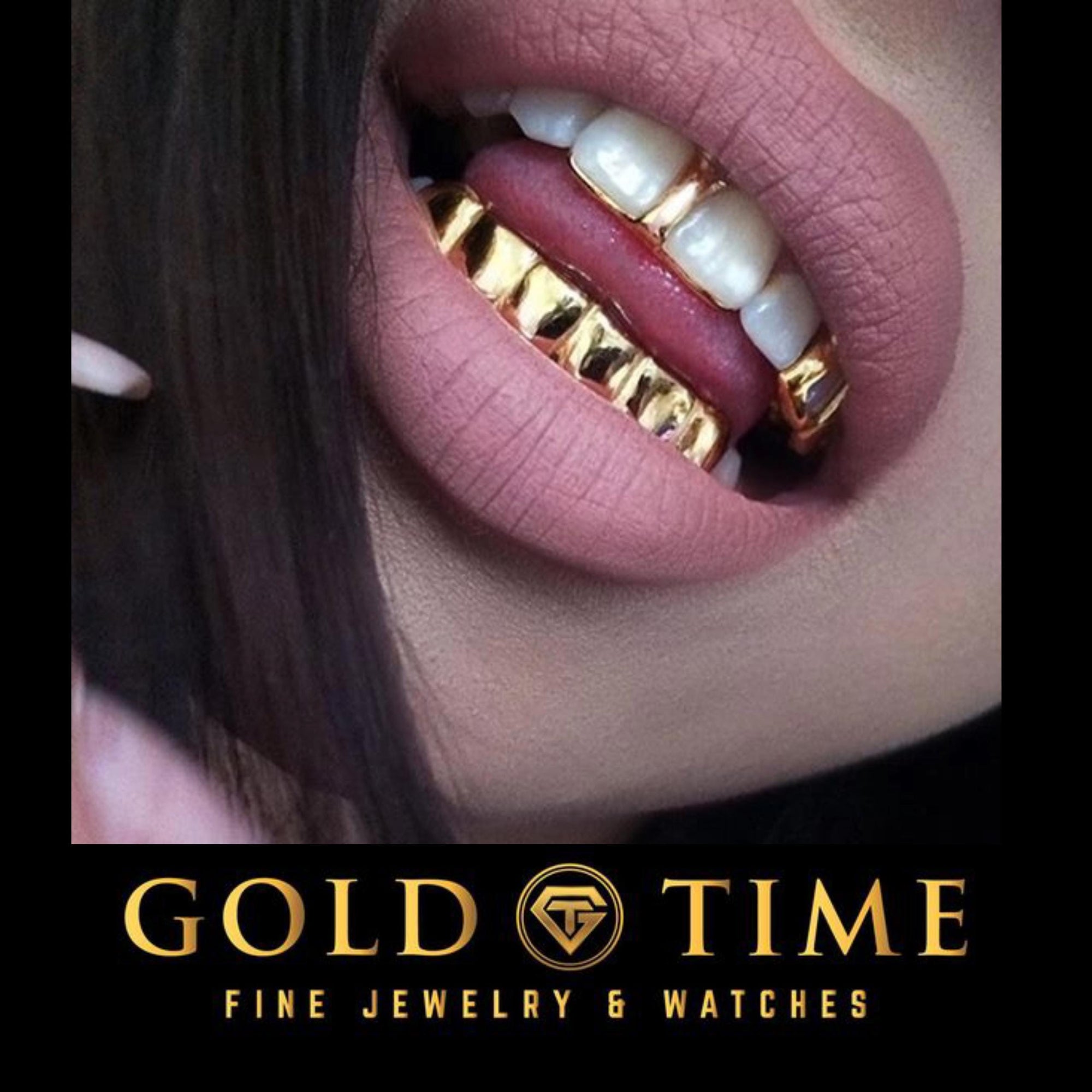 How Long Do Custom Grillz Last?