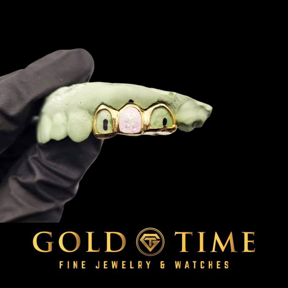 Can I Get Grillz If I Have Crooked Teeth?