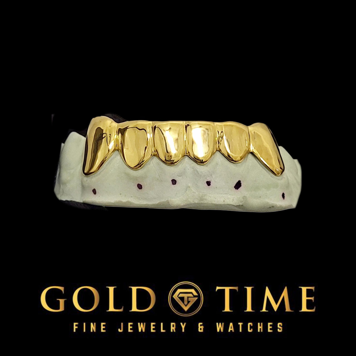 Can You Get Grillz With Veneers, Crowns, or Dental Implants?