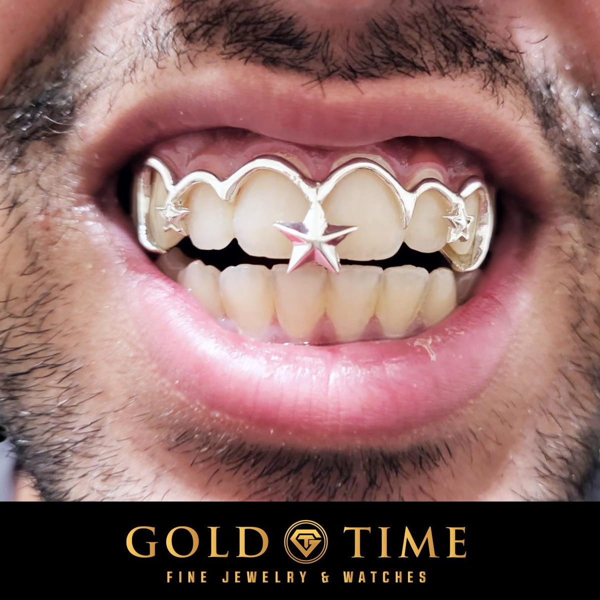 Who Made Grillz Popular? The Real History of Grillz, From the Streets of Brooklyn to Everyday Fashion