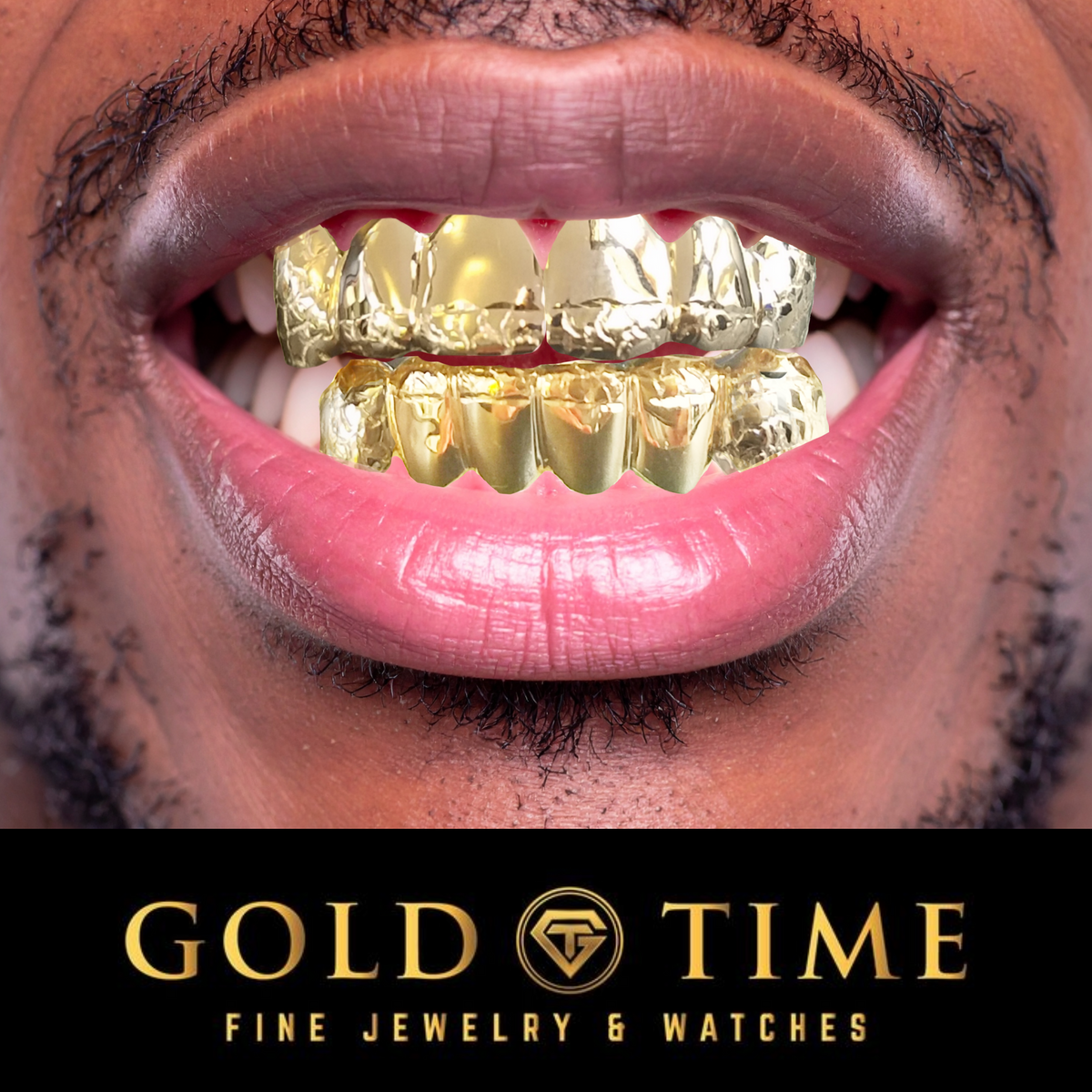 Silver vs Gold Grillz: Which Should You Choose?