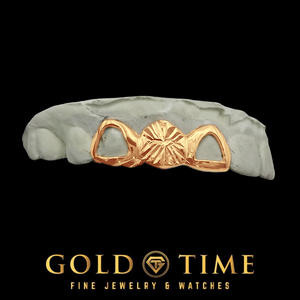 Rose gold 3 piece grill with a starburst diamond-cut center cap between two open face caps on a dental mold