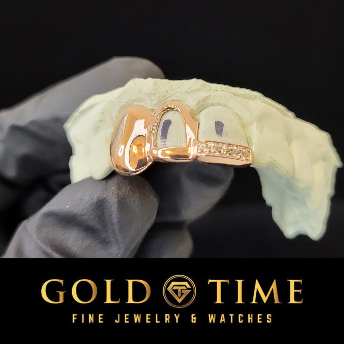 Rose tone grillz on a model with 'Gold Time' branding at the bottom.