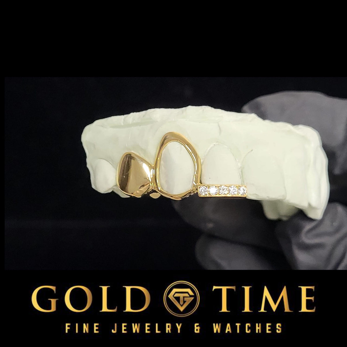 gold 3 piece grillz with iced tip, open face and solid design on mold