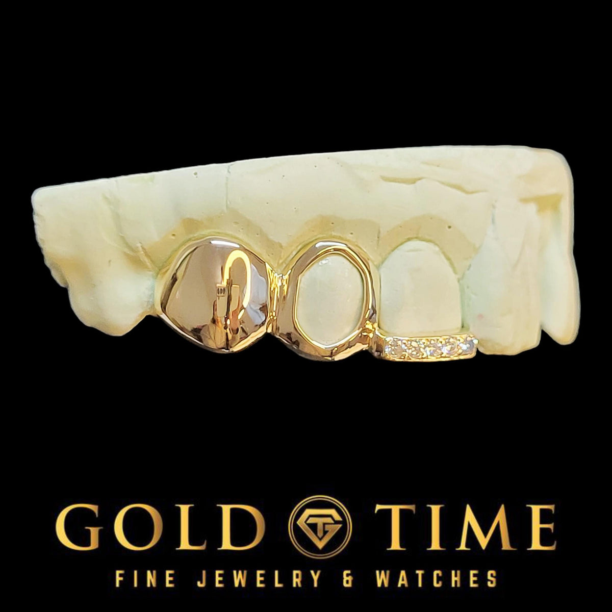 Gold and white grill on teeth with 'Gold Time' branding on a black background