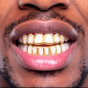 Smiling man wearing custom gold open face grillz on his top and bottom teeth