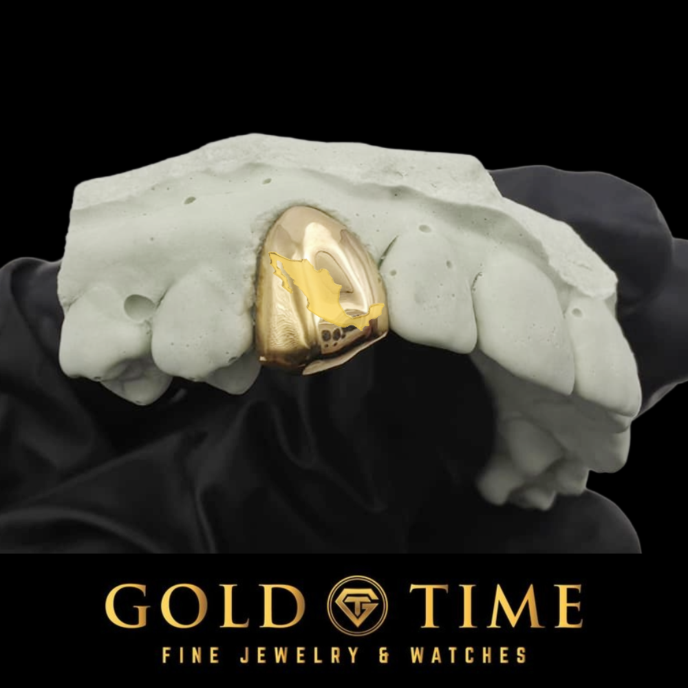 Yellow gold single tooth cap engraved with the state of Texas, shown on a dental mold