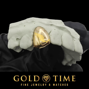 Yellow gold single tooth cap engraved with the state of Texas, shown on a dental mold