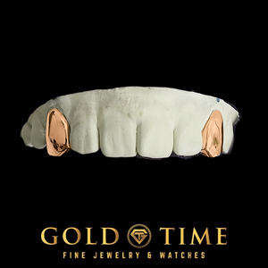 Rose gold 2 piece solid canine caps on a top dental mold