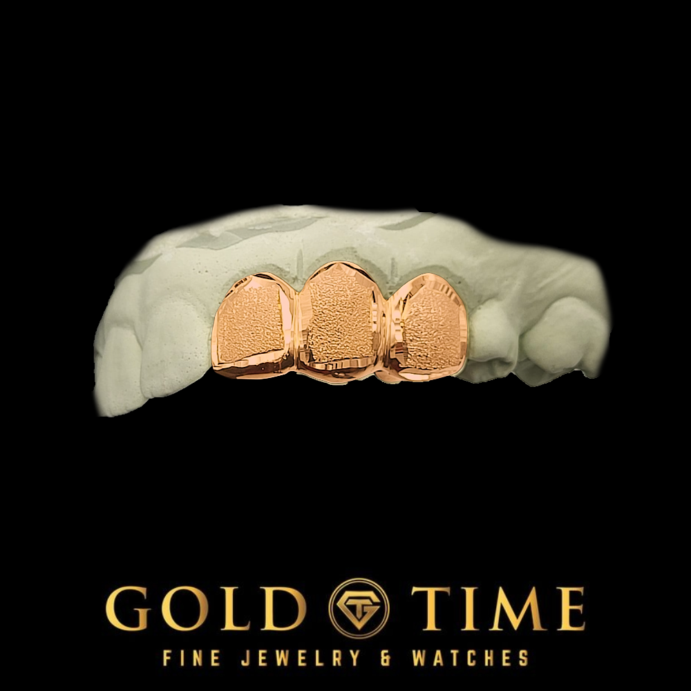 Three textured rose gold grillz on a white dental mold, displayed against a solid black background with the Gold Time logo at the bottom.