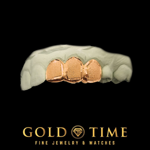 Three textured rose gold grillz on a white dental mold, displayed against a solid black background with the Gold Time logo at the bottom.