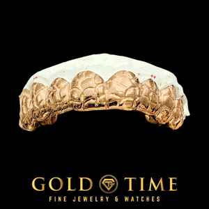 A nugget textured rose gold grillz displayed on a white dental mold against a solid black background, with the Gold Time brand logo at the bottom.