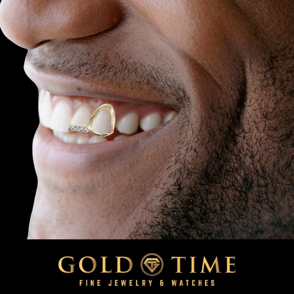 man wearing two piece grillz with open face and trillion diamond-cut tip