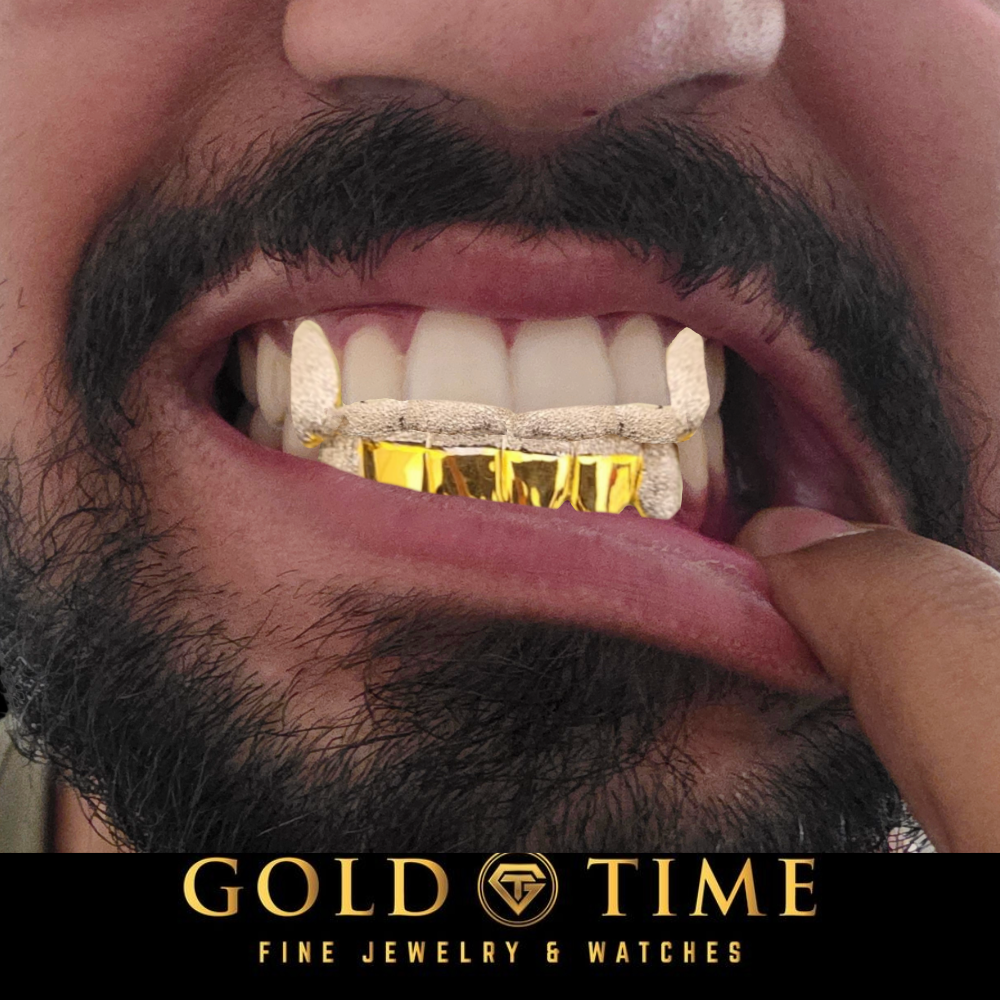 Close-up of a man's mouth showing a gold tooth grill on his upper teeth, with a finger pulling the lower lip to display the grill. A black banner at the bottom reads 'GOLD TIME FINE JEWELRY & WATCHES'.