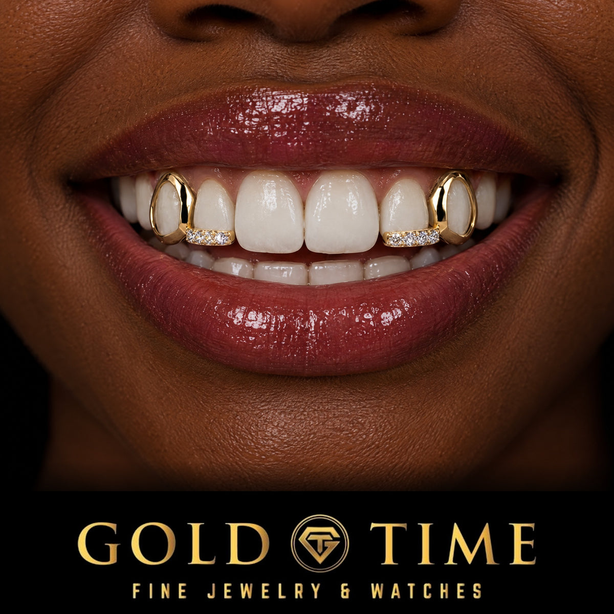 Woman smiling in a yellow gold 4 piece grill with open face canines and moissanite tips on the incisors, Gold Time
