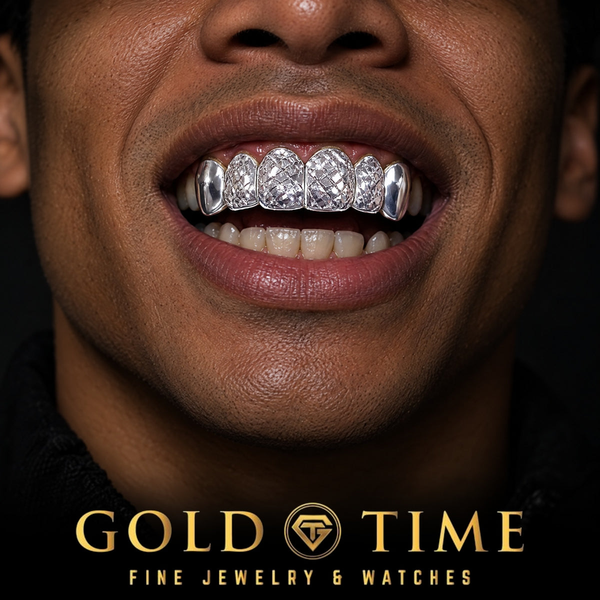 Close up smile with 6 piece trillion cut grillz and polished solid canine caps, Gold Time