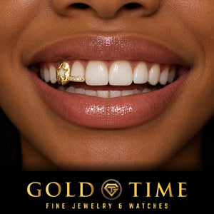 Woman smiling in a yellow gold double cap grill with a star cutout canine cap and a moissanite tip on the incisor, Gold Time
