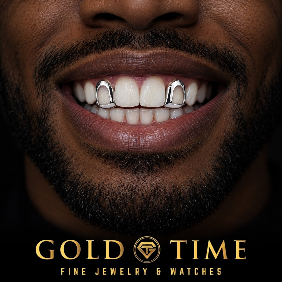 Man smiling in white gold open face caps on both upper side incisors with natural front teeth, Gold Time