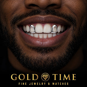 Man smiling in white gold open face caps on both upper side incisors with natural front teeth, Gold Time