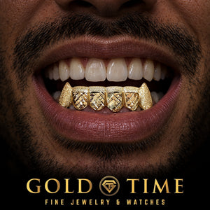 Custom grillz, 6 Piece Trillion Cut with Dust Tips and Fangs, worn in a smile, lifestyle photo 1, Gold Time