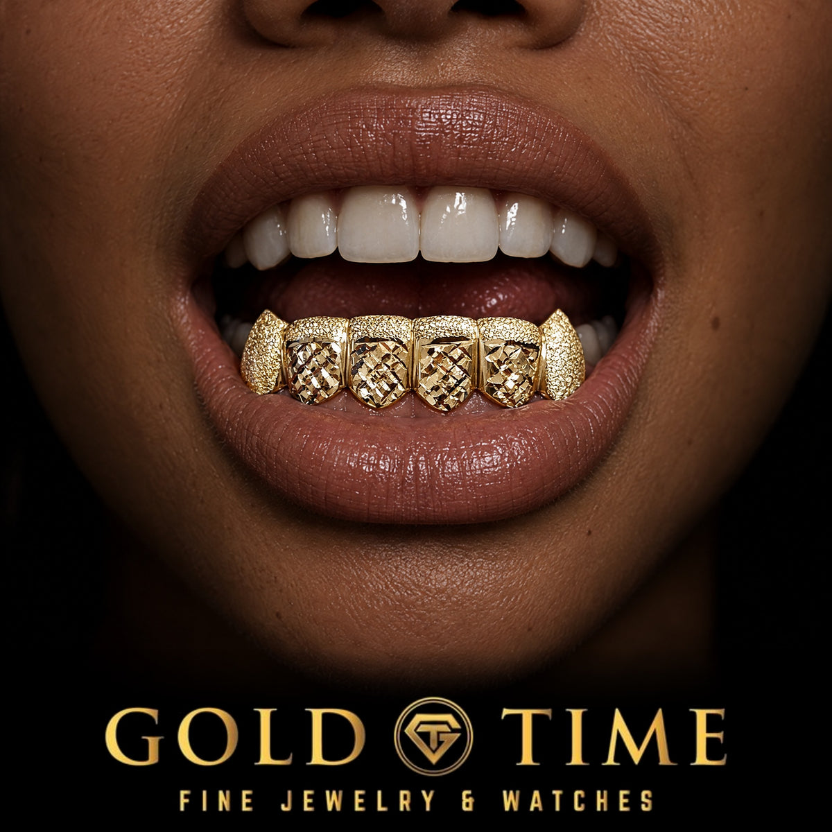 Custom grillz, 6 Piece Trillion Cut with Dust Tips and Fangs, worn in a smile, lifestyle photo 2, Gold Time