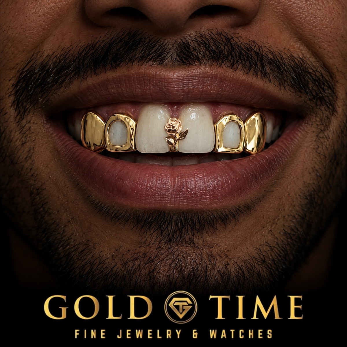 Custom grillz, 5 Piece Rose Gap, Open Face, Solid Canines, worn in a smile, lifestyle photo 1, Gold Time