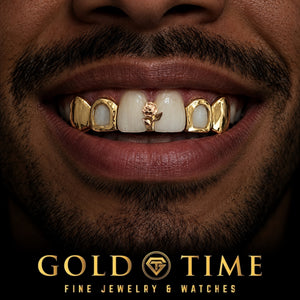 Custom grillz, 5 Piece Rose Gap, Open Face, Solid Canines, worn in a smile, lifestyle photo 1, Gold Time
