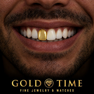 Custom grillz, Single Tooth Solid Cap, worn in a smile, lifestyle photo 1, Gold Time