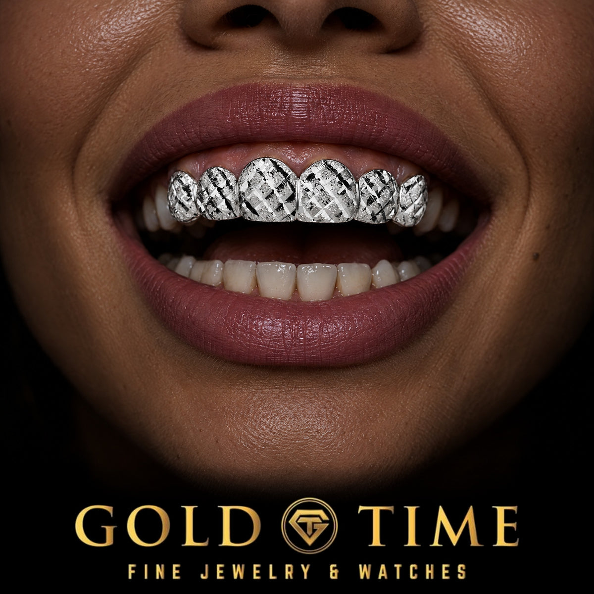 Custom grillz, 6 Piece Trillion Cuts and Diamond Dust, worn in a smile, lifestyle photo 2, Gold Time