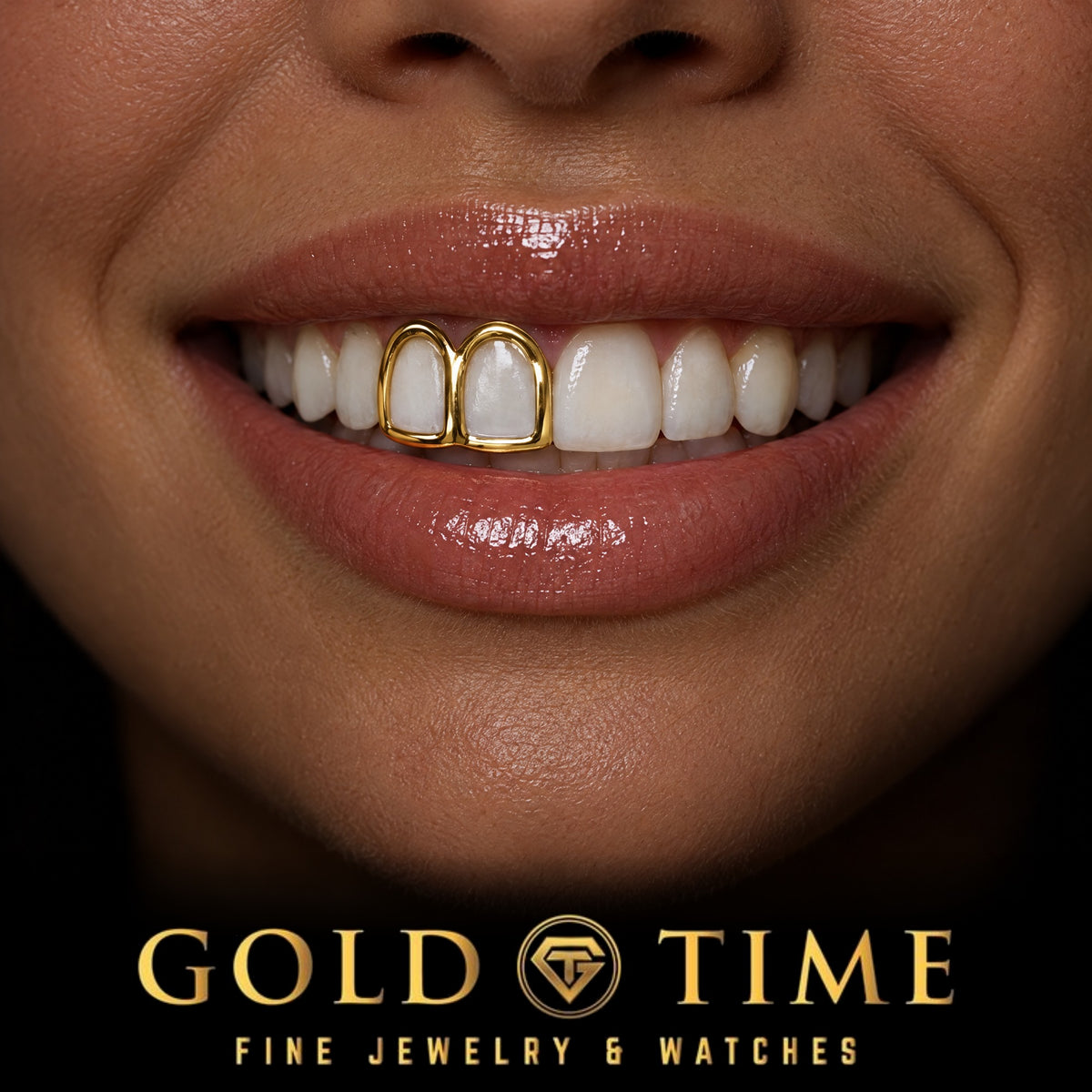 Custom grillz, Open Face Double Cap, worn in a smile, lifestyle photo 2, Gold Time