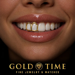 Custom grillz, Open Face Double Cap, worn in a smile, lifestyle photo 2, Gold Time