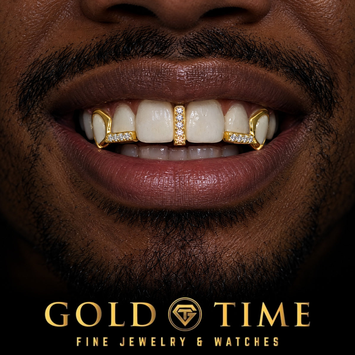 Custom grillz, 5 Piece Moissanite Gap Bar, Open Face Canines, worn in a smile, lifestyle photo 1, Gold Time