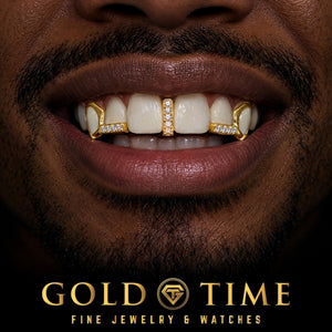 Custom grillz, 5 Piece Moissanite Gap Bar, Open Face Canines, worn in a smile, lifestyle photo 1, Gold Time