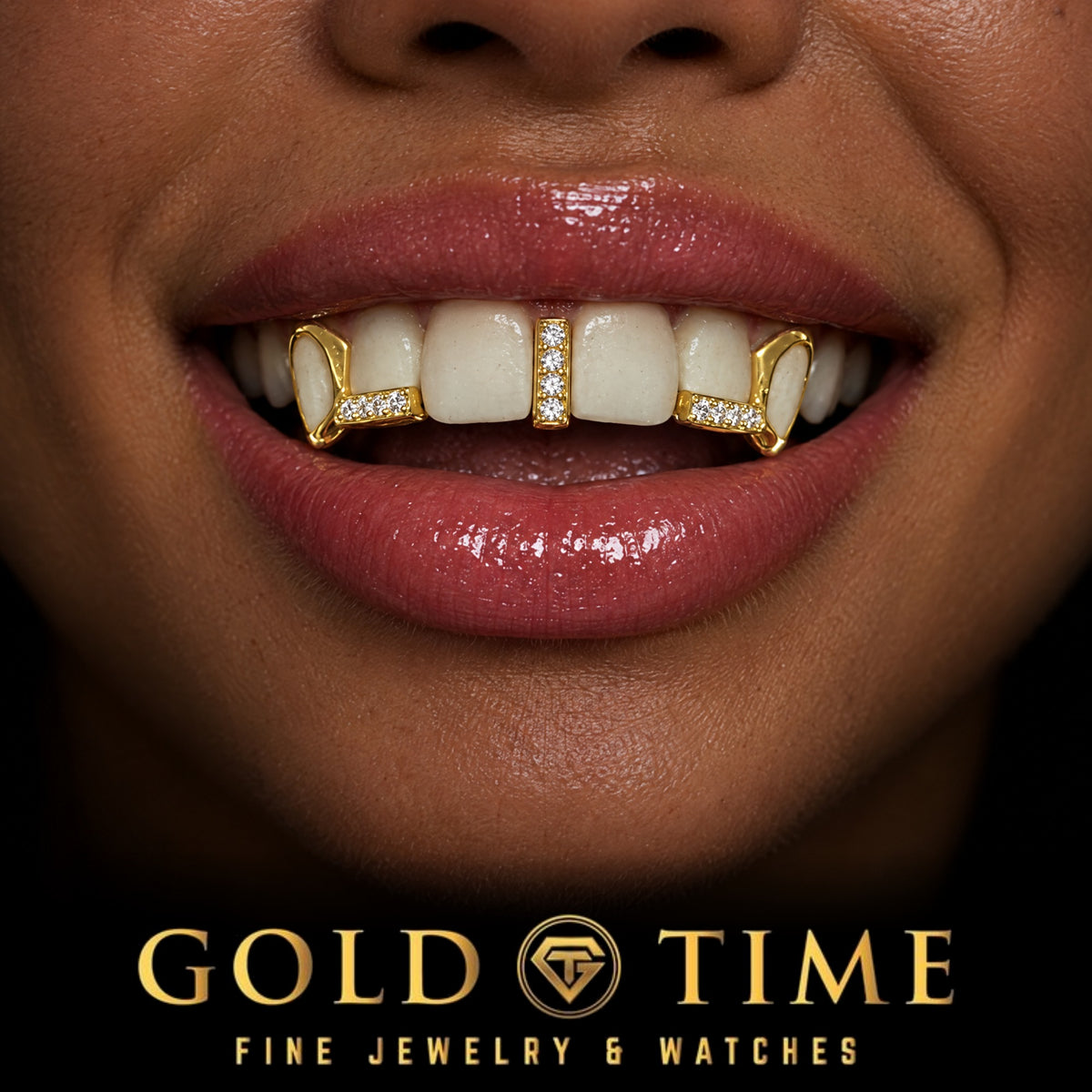 Custom grillz, 5 Piece Moissanite Gap Bar, Open Face Canines, worn in a smile, lifestyle photo 2, Gold Time
