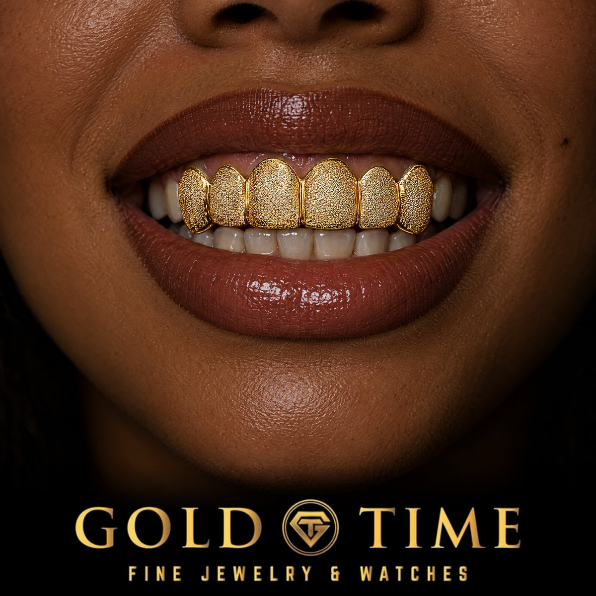 6 Piece Diamond Dust Grillz, worn in a smile, lifestyle photo 2, Gold Time