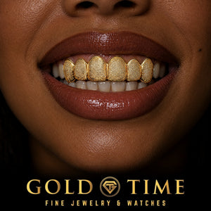 6 Piece Diamond Dust Grillz, worn in a smile, lifestyle photo 2, Gold Time