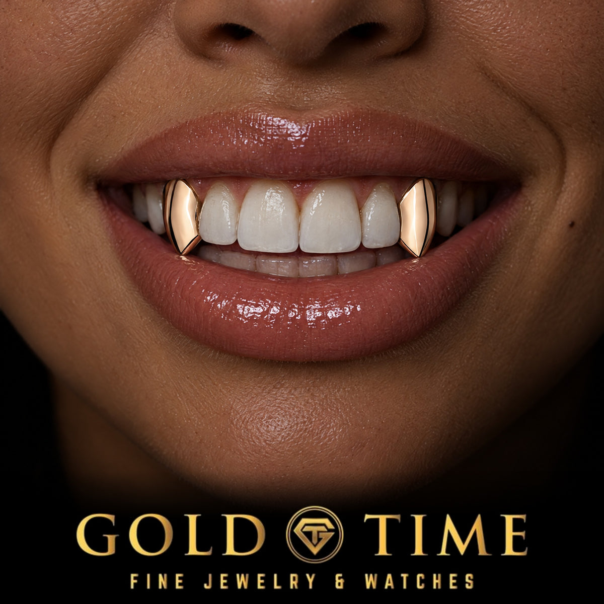 Custom grillz, Gold Fangs, 2 Piece, worn in a smile, lifestyle photo 2, Gold Time
