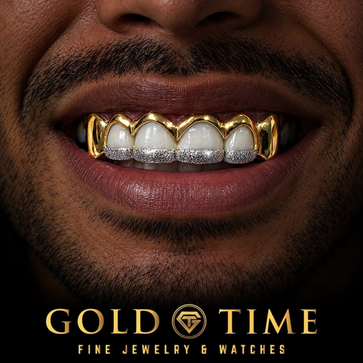 Custom grillz, 6 Piece Open Window, Dust Tips, Solid Canines, worn in a smile, lifestyle photo 1, Gold Time