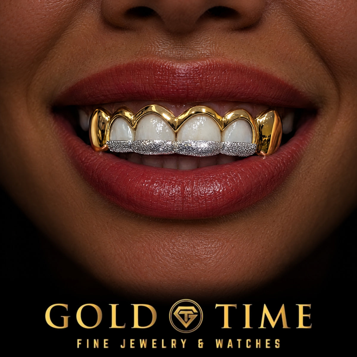 Custom grillz, 6 Piece Open Window, Dust Tips, Solid Canines, worn in a smile, lifestyle photo 2, Gold Time